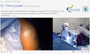 Vidéos intervention Dr JOUDET | Clinique Chirurgicale du Libournais