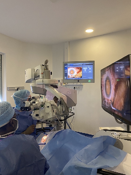 img chirurgie cataracte astigmatisme glaucome - docteur thomas darquies - chirurgien ophtalmologiste a la clinique chirurgicale du libournais #2