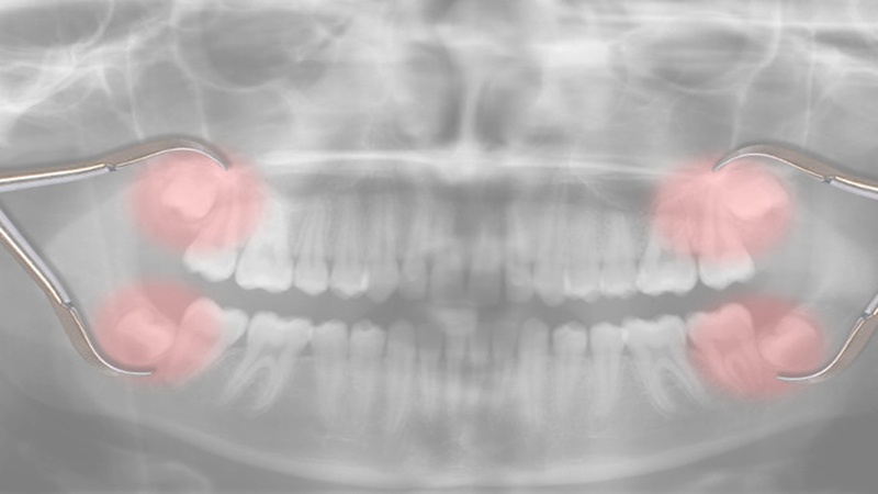 Chirurgie Dentaire � la Clinique Chirurgicale du Libournais