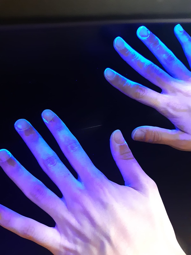 journee actions hygiene mains - test friction mains #2 - clinique chirurgicale du libournais